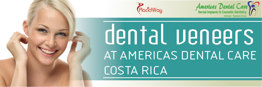 Dental Veneers at Americas Dental Care Costa Rica